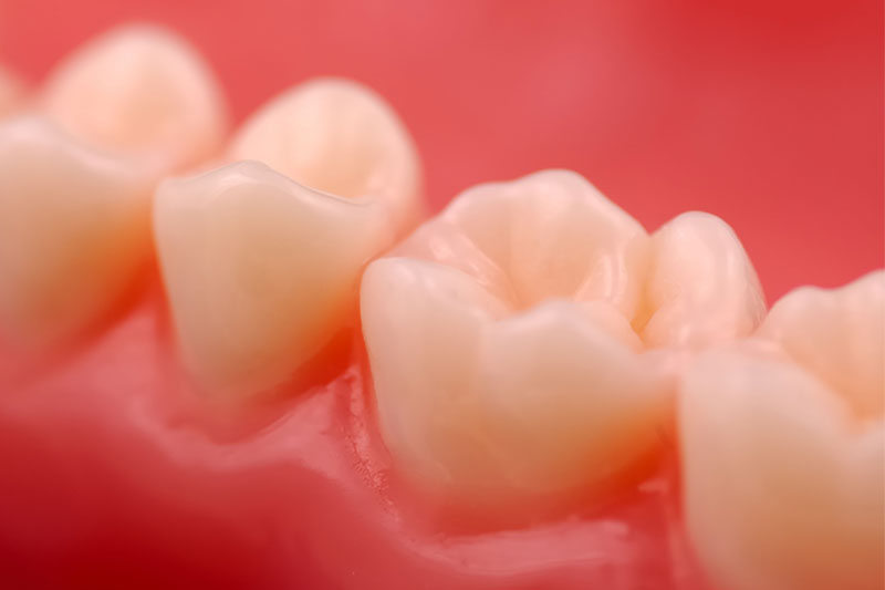 Composite Tooth Fillings | Fort Worth Dentist | Thomas L. Phillips Jr., DDS